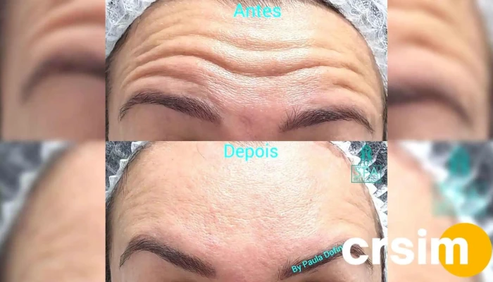 Clinica De Estetica Spa Beleza Top Cilio - Porciúncula